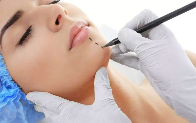 What To Expect After A Plastic Surgery