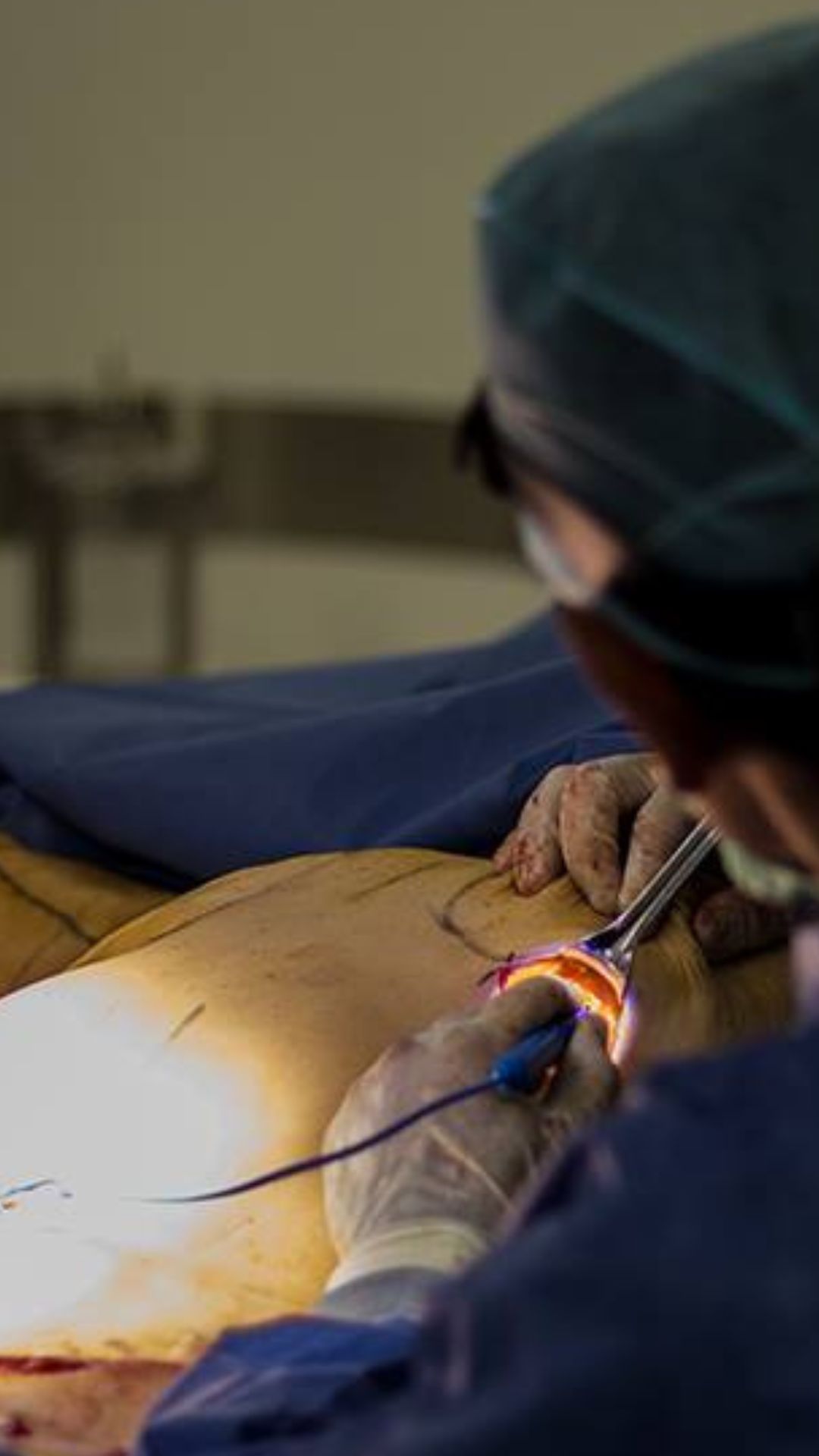 Reconstructive surgeon performing surgery on a patient at CER Hospital.