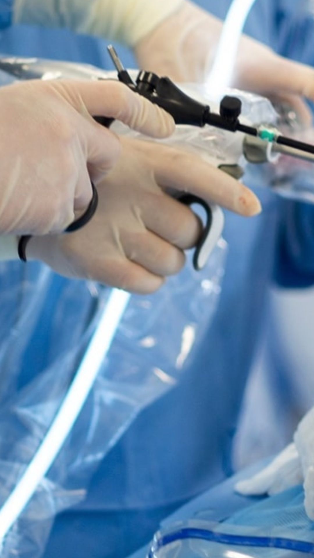Close-up of a surgical device in hand during a bariatric procedure at CER Hospital.
